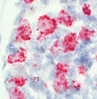 Viral-vector-in-neurons-(1) microscope image of gene cells