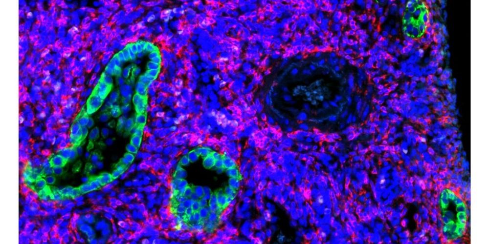 A scientific image that is mainly blue and pink blobs, with 4 larger blobs of cells that are bright green and blue.