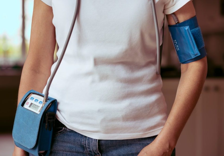 Woman,Wearing,A,24-hour,Ambulatory,Blood,Pressure,Monitor,At,Home, Woman wearing a blood pressure monitor